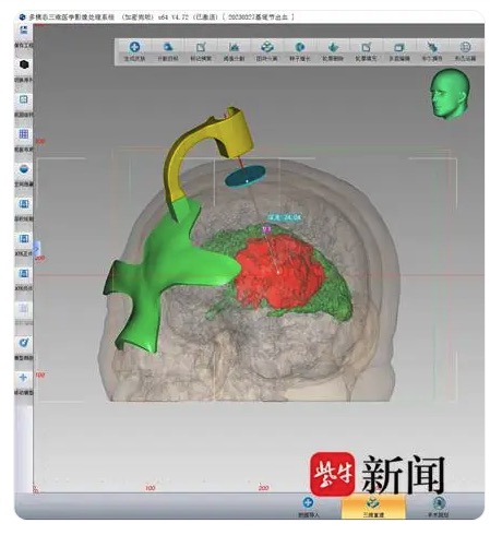 3Dӡg(sh)׌Xt(y)ʄӵ